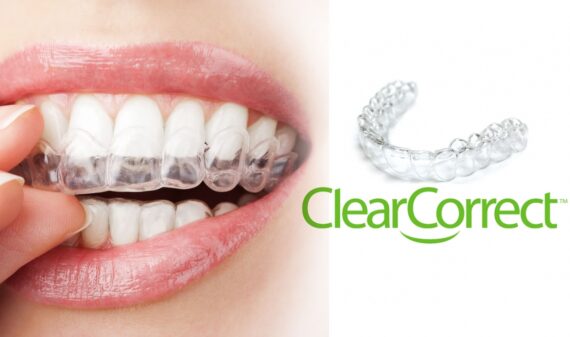 Brickell Dental Care Clear Correct Affordable price Monthly payment